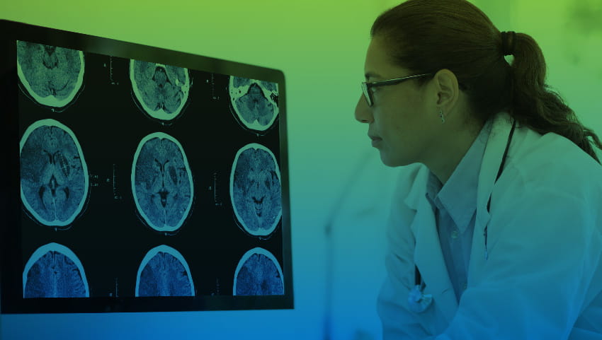 scientist looking at the brain of a patient in a cns clinical trial